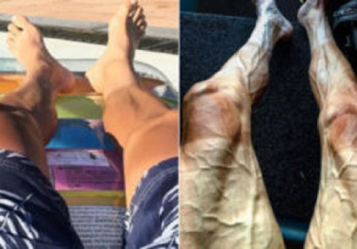 ZASTRAŠUJUĆE Evo kako biciklistu izgledaju noge prije i tijekom Tour de Francea