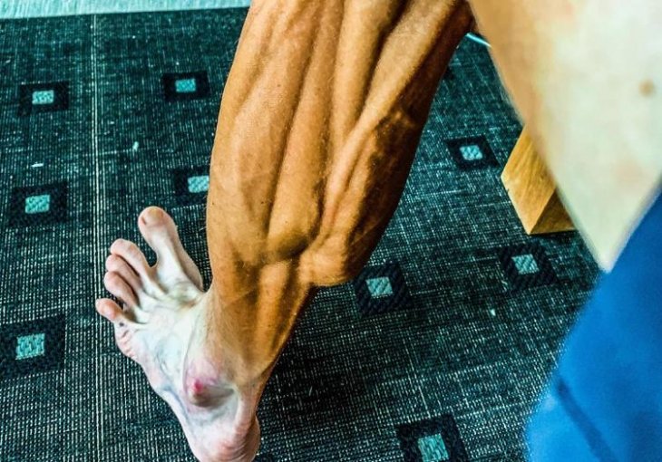 JEZIVE FOTOGRAFIJE SLOVENSKOG SPORTISTE ŠOKIRALE BALKAN Šta mu je sa nogom?!