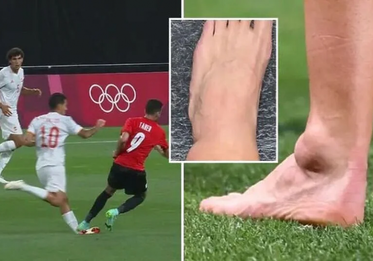 Igrač madridskog Reala objavio sliku povrijeđene noge, nije za one slabog srca..