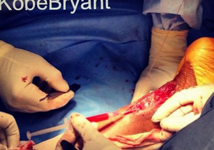 Kobe Bryant objavio fotografiju s operacije Ahilove tetive