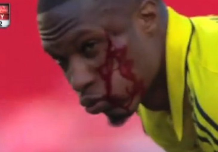 Ovaj je potez Thierry Henrya zgrozio američku javnost