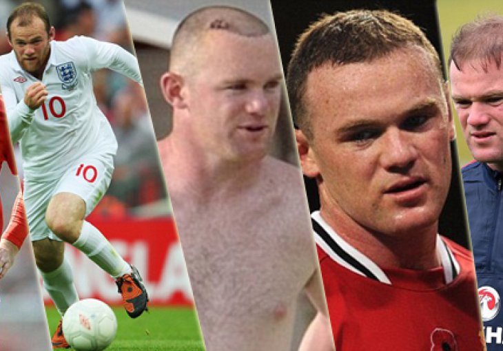 Rooney opet presađivao kosu, zbog toga se otimaju za njega