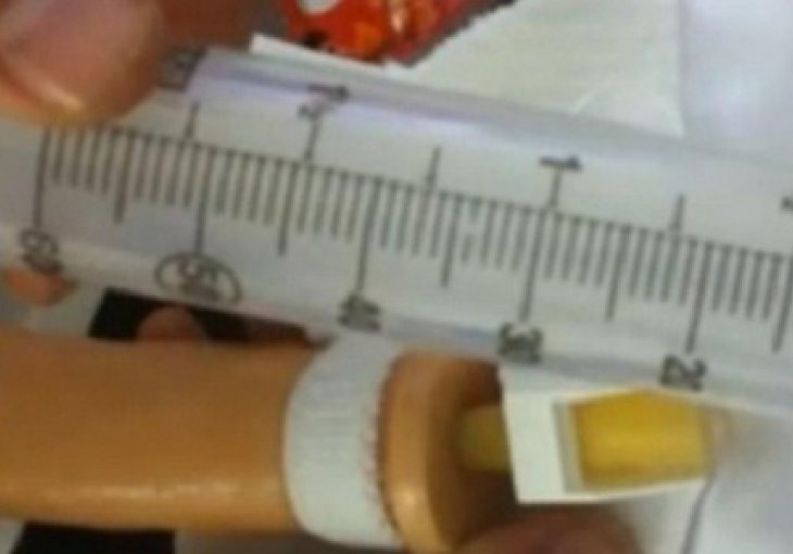 Lažni penis je novi način varanja na doping-testu