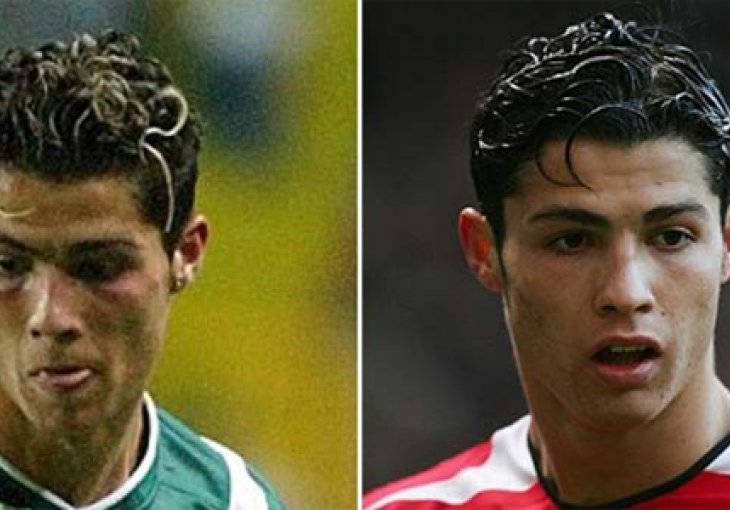 Ronaldo ne razumije zašto je imao kosu 