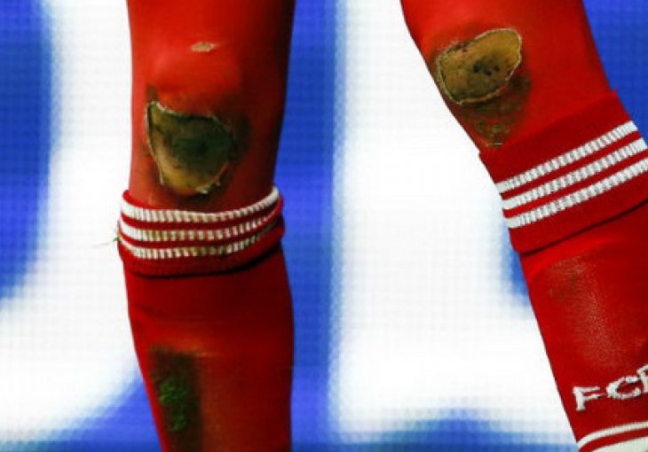 Pogledajte kako je Robben proslavljao gol i poderao koljena pri tom