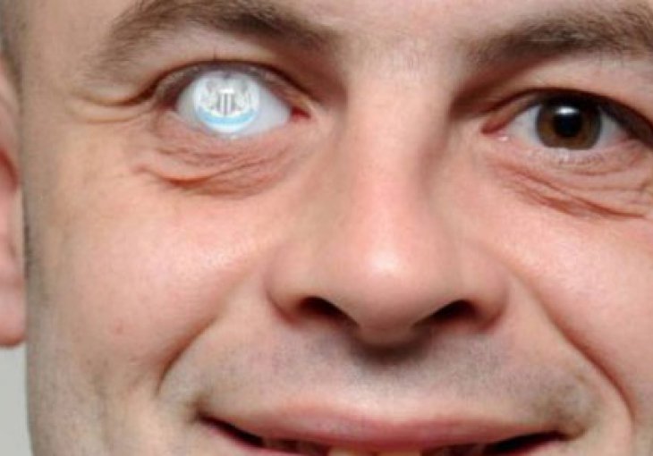 Fanatizam: Grb voljenog kluba umjesto oka