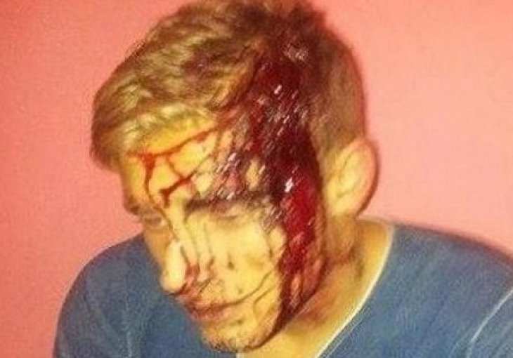 Engleski fudbaler napadnut sjekirom