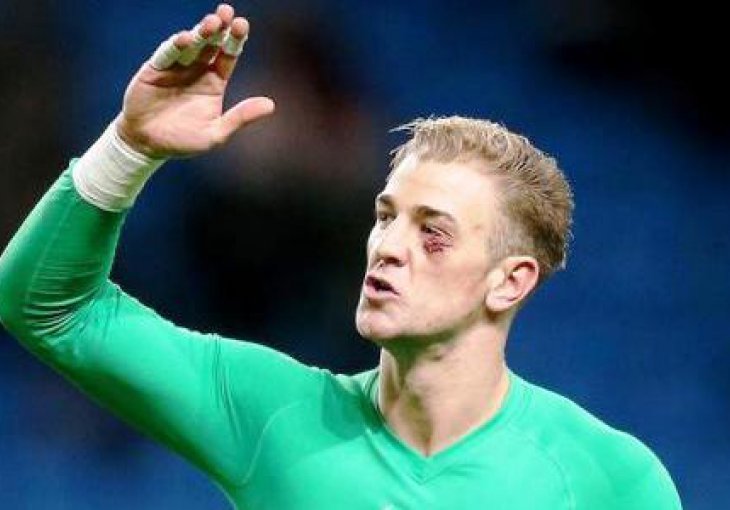 Joe Hart dobro prošao nakon duela s napadačem Palacea