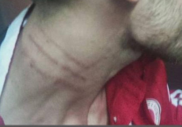 Stravične fotografije iz svlačionice Albanije: Hvala dragom Allahu da nas je sačuvao