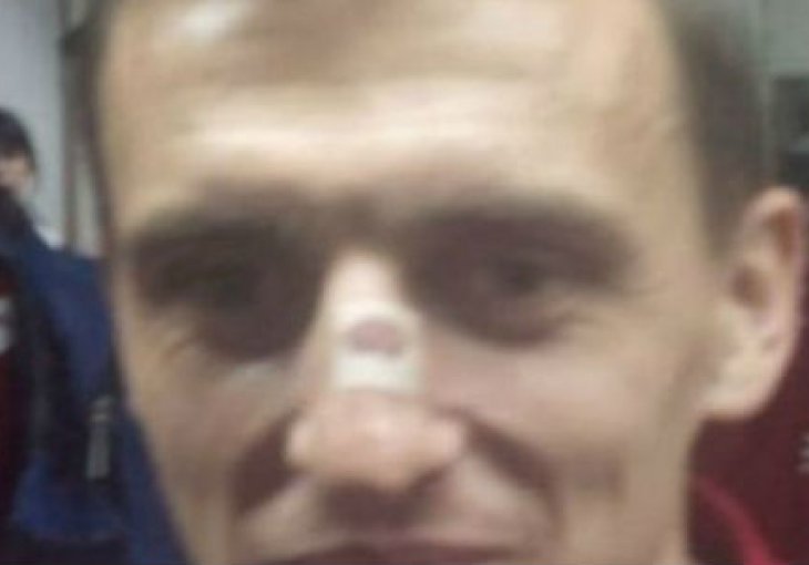 Albanski reprezentativci se 'pohvalili' ožiljcima