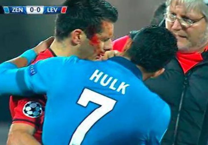 Emir Spahić sav krvav napustio teren