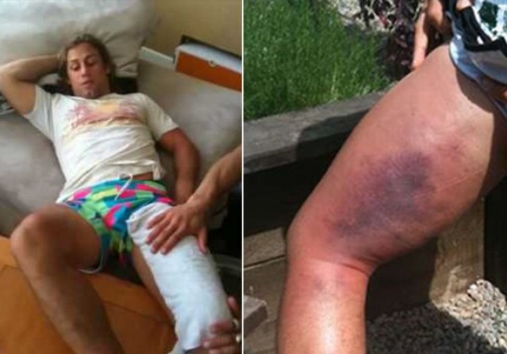 Faber: Jose Aldo ima razorne nožne udarce 