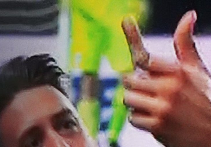 Horor povreda napadača Hoffenheima nakon duela sa Ibiševićem 