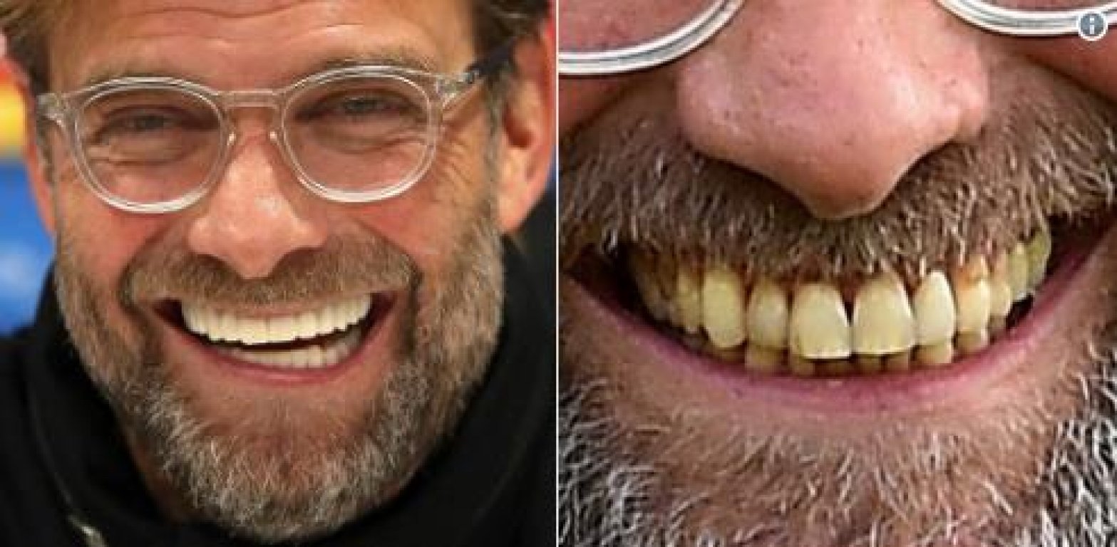 klopp
