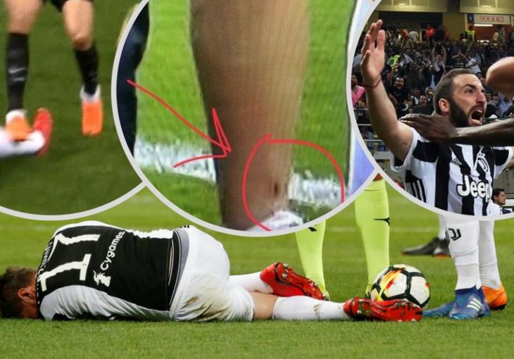 Mandžo preko sat igrao s rupom u nozi: Nakon meča pokazao strašnu povredu, navijači u nevjerici
