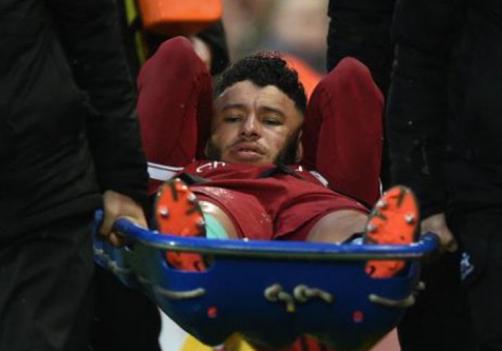 TEŽAK UDARAC ZA REDSE: Oxlade-Chamberlain propušta veći dio nove sezone