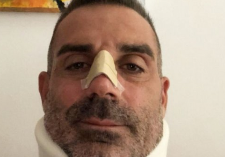 NAKON ŠTO GA UDARIO Golman Chieva iz bolnice poslao poruku Ronaldu
