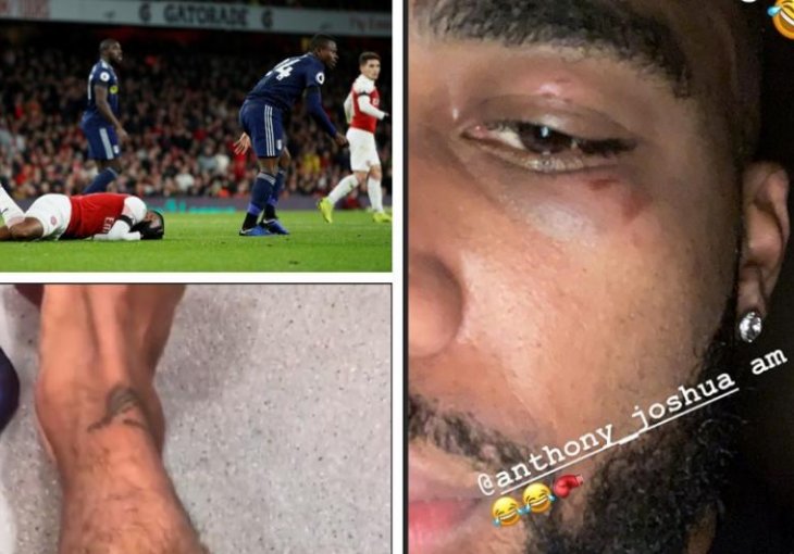 Zvijezda Arsenala pokazala 'šljivu' pa poručila: Joshua, spreman sam! Odgovor saigrača USIJAO je Instagram