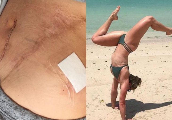 BICIKLISTKINJA SE POVRIJEDILA: Prelijepa sportistkinja objavila ovu fotografiju I ZALUDILA SVIJET