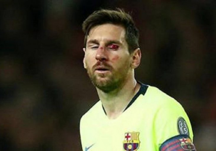 PANIKA U BARCI Zbog užasne povrede Messi ne igra revanš?!
