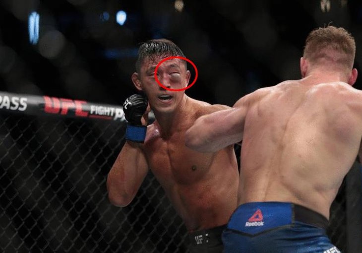 PAZITE DA NE POVRATITE: UFC-ov borac ostao bez oka, protivnik ga unakazio!