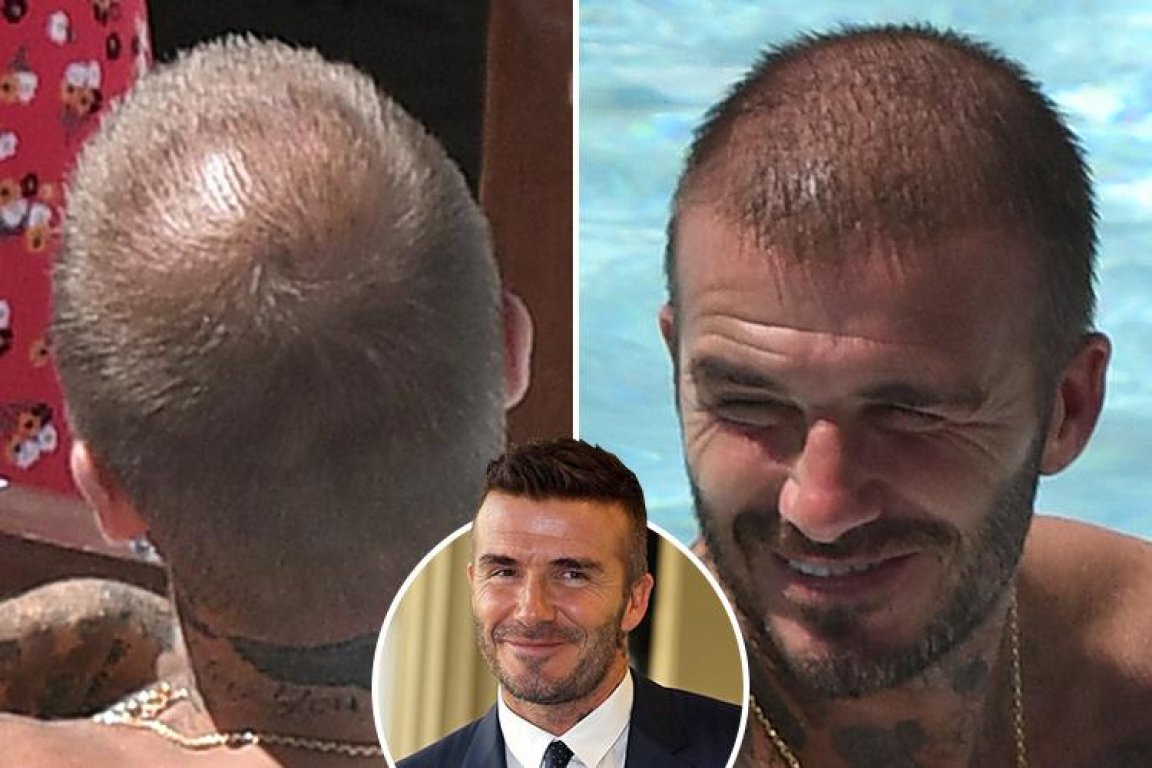 jh-composite-beckham-golden-bald