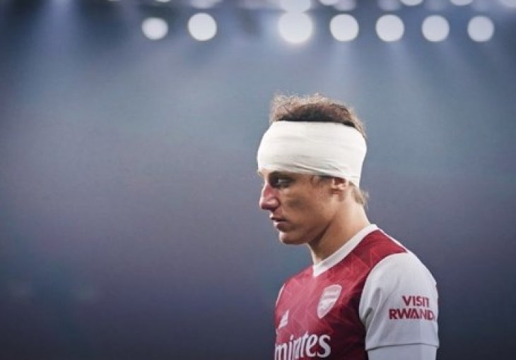 Arsenal je Luiza platio devet miliona eura i  dobio najgoreg braniča lige