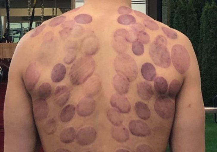 AMERIKANCI GLEDALI U ČUDU: NBA košarkaš objavio fotografiju svojih leđa, ovo nisu tetovaže: Ovim je Phelps stizao i do zlata