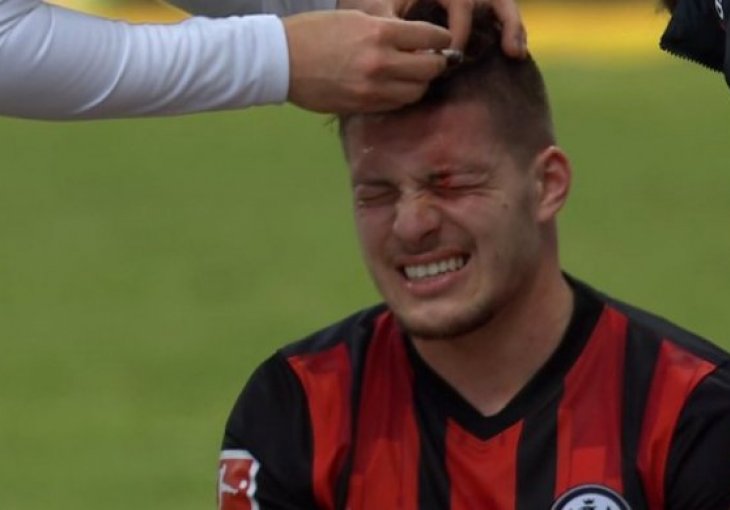 JOVIĆU RAZBILI GLAVU! Štoper BAJERNA divljački udario fudbalera! /FOTO/