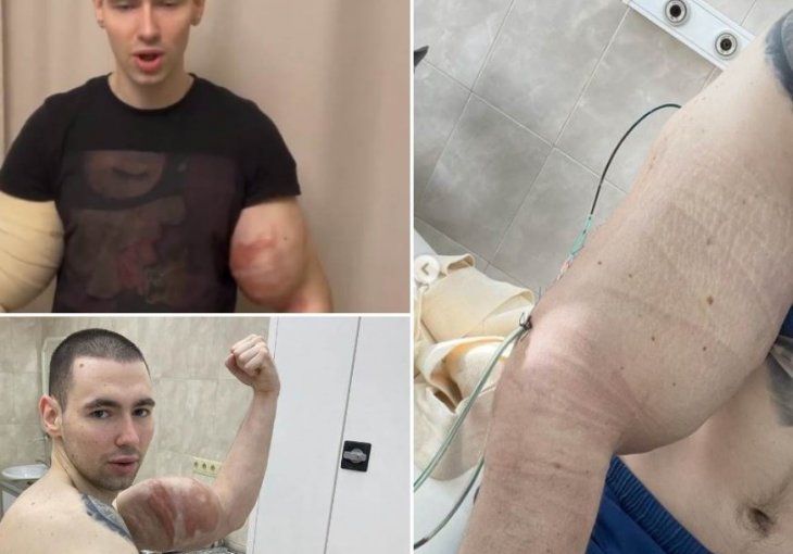 RUSKI POPAJ IMA NAJVEĆE BICEPSE, UBRIZGAO ULJE U OBJE RUKE I JEDVA OSTAO ŽIV: Hitno operisan, stigle nove vijesti