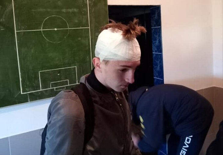 SKANDALOZNO: Fudbaler pogođen pivskom flašom