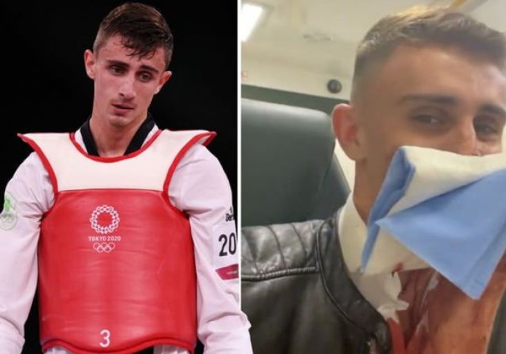UZNEMIRUJUĆE! Irski Olimpijac će morati na rekonstrukciju lica 