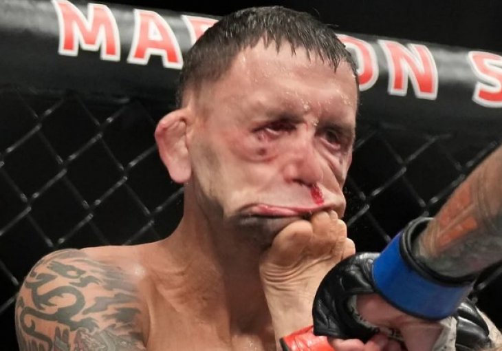Lice legendarnog UFC borca postalo spljošteno nakon udarca nogom: Ovo nije fotošop!