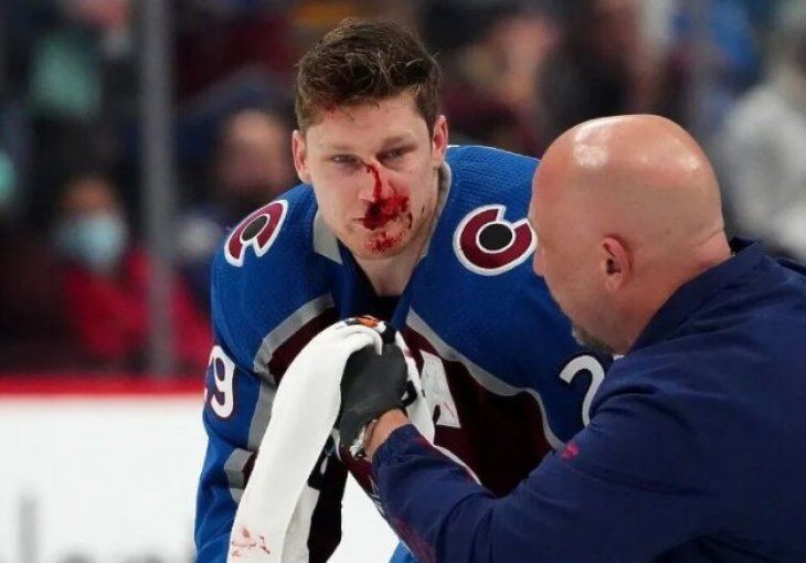 NHL zvijezdi nakon brutalnog starta slomljene sve kosti na licu