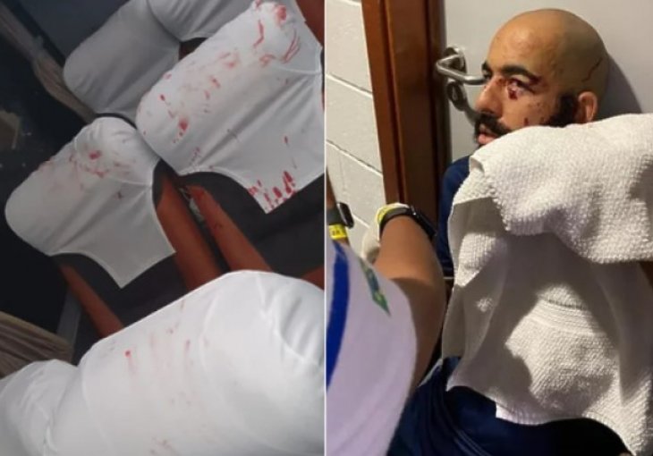 Bomba bačena na autobus nogometne ekipe, golman hospitalizovan, još dvojica povrijeđenih