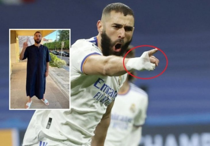 Benzema uvijek igra s bandažom, konačno je pokazao kako mu izgleda mali prst desne ruke
