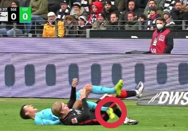 STRAVIČNA POVREDA POTRESLA BUNDESLIGU Kost je skoro prošla kroz čarapu, fudbaleru se za 180 stepeni okrenula noga