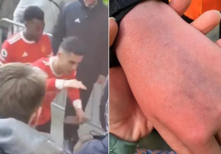 Ima autizam i prvi put je došao na utakmicu, a onda ga je Ronaldo udario po ruci i razbio mu telefon: Oglasila se njegova majka i objavila slike