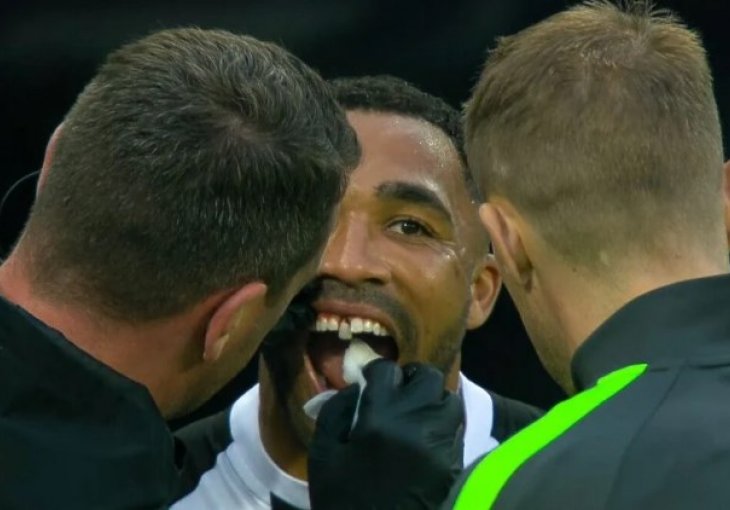 SCENA POSTALA HIT NA INTERNETU: Napadač Newcastlea ostao bez zuba za vrijeme utakmice protiv Arsenala