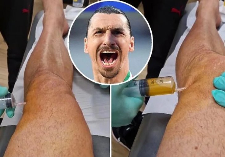 UZNEMIRUJUĆI SNIMAK Ibrahimović otkrio kako izgleda brutalno dreniranje koljena koje radi svake sedmice