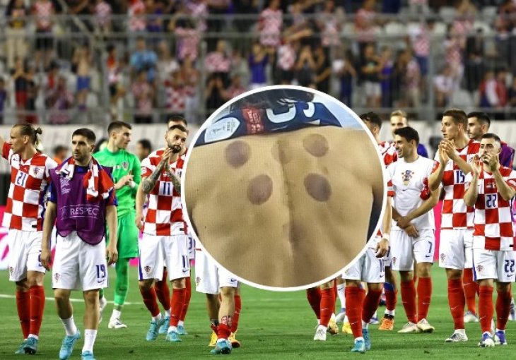 Reprezentativac Hrvatske se odlučio na poznati tretman, fanovi ga povezali s Benzemom