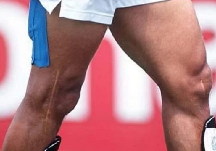Strašnija i od Ronaldovih: Čuvena koljena puna ožiljaka kao jeziva uspomena na veliku karijeru