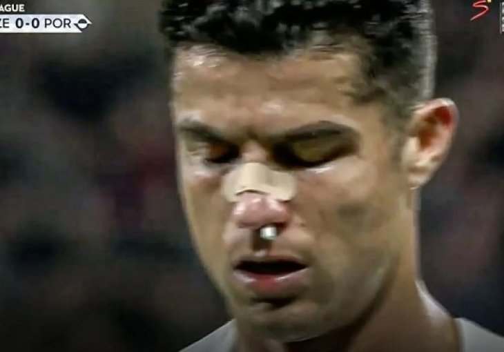 Ronaldu je spao flaster s nosa, a onda su se mnogi upitali kako je uopšte nastavio utakmicu 