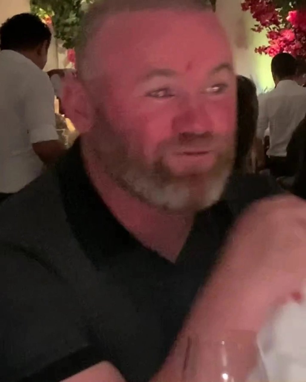 wayne-rooney-left-bleeding-cut-771038674