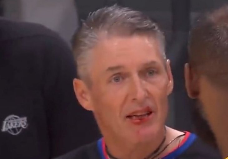 LeBron slučajno sucu razbio usnicu: 