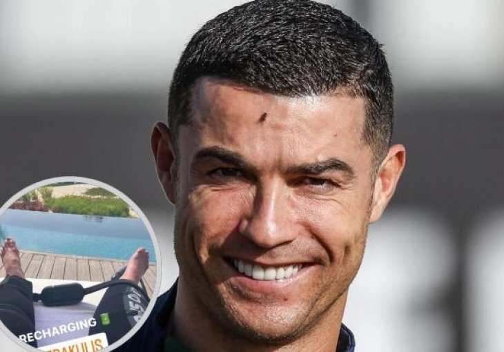 SVI SU U ČUDU: Cristiano Ronaldo šokirao svoje fanove izgledom stopala od 