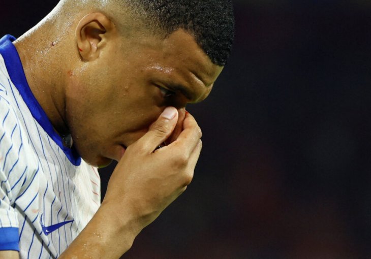 Francuzi u šoku: Mbappe slomio nos i mora na operaciju, za njega je Euro završen?