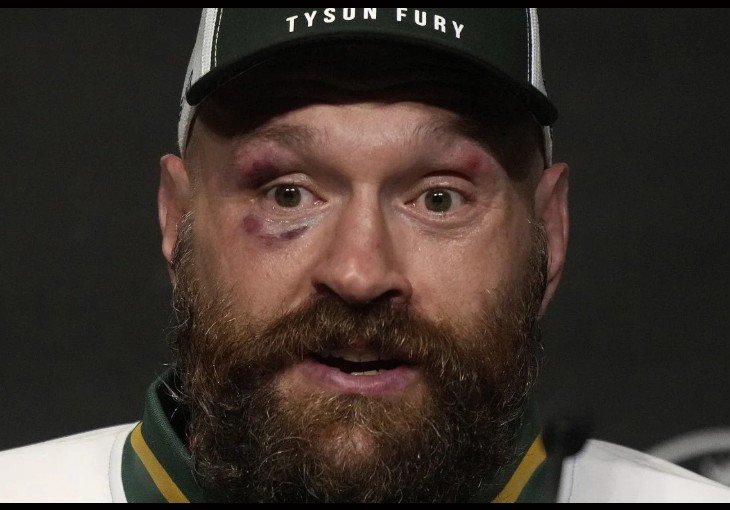 Nevjerovatno je šta duboko iza ponoći radi Tyson Fury: 